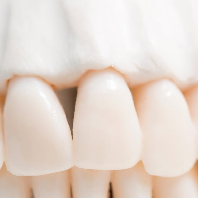Couronne zircone unitaire — Dentalis France