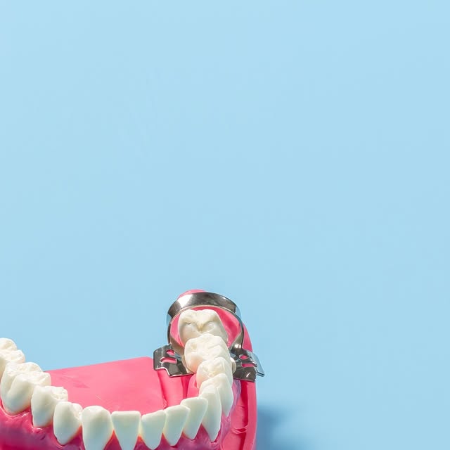 Travail prothétique — Dentalis France